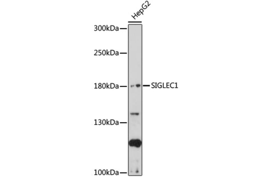 Western Blot - Anti-Sialoadhesin/CD169 Antibody (A92856) - Antibodies.com