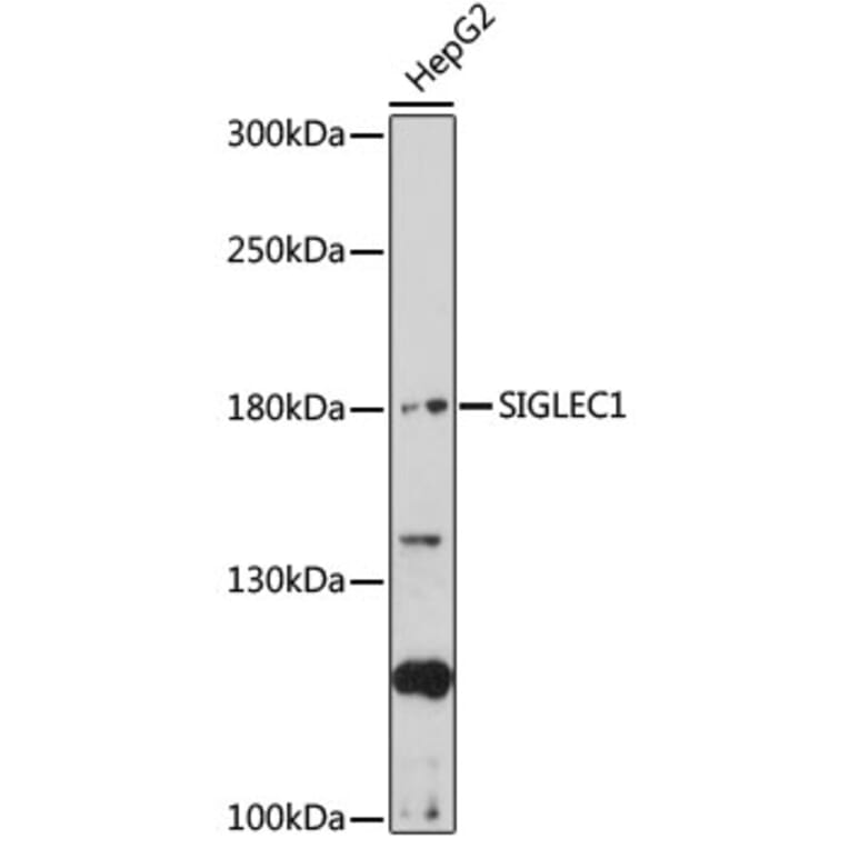 Western Blot - Anti-Sialoadhesin/CD169 Antibody (A92856) - Antibodies.com