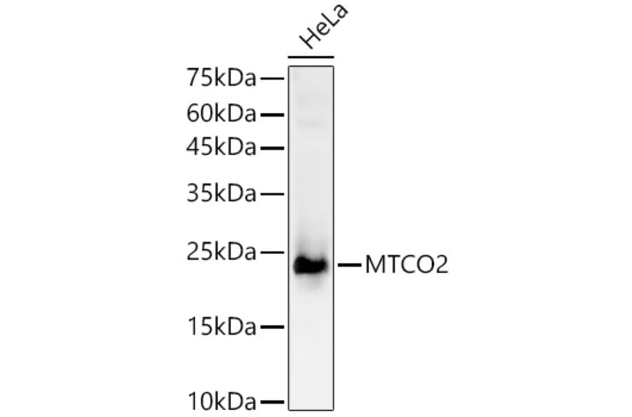Western Blot - Anti-MTCO2 Antibody (A92857) - Antibodies.com