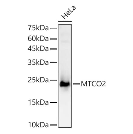 Western Blot - Anti-MTCO2 Antibody (A92857) - Antibodies.com