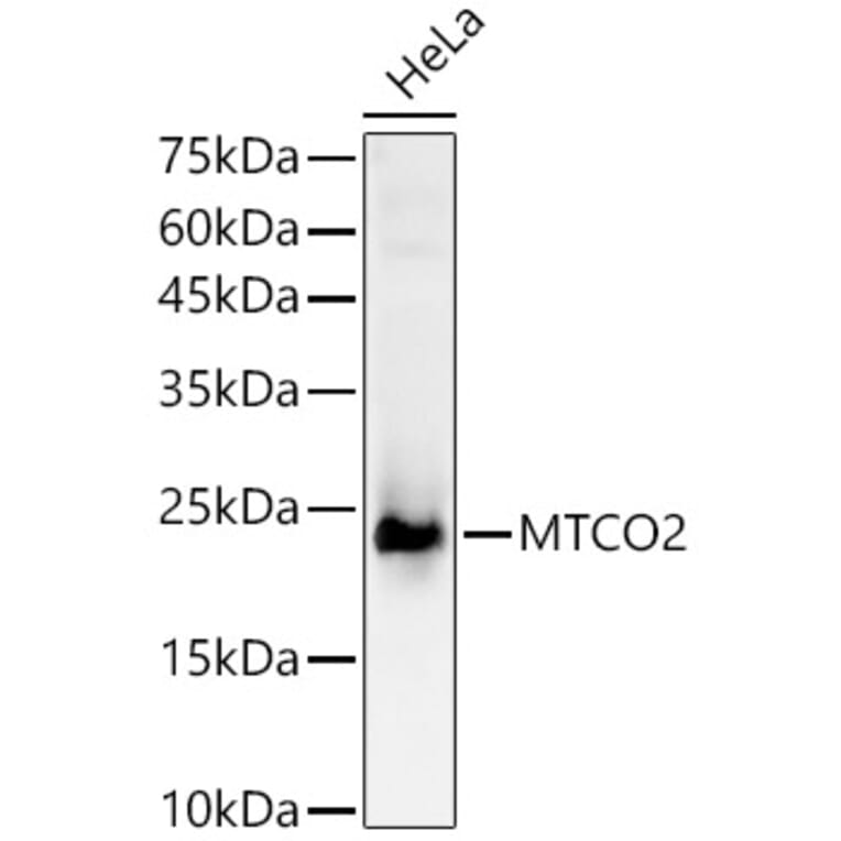 Western Blot - Anti-MTCO2 Antibody (A92857) - Antibodies.com