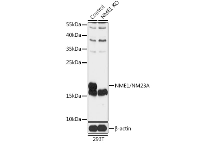 Western Blot - Anti-NM23A Antibody (A92861) - Antibodies.com