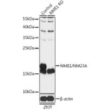 Western Blot - Anti-NM23A Antibody (A92861) - Antibodies.com