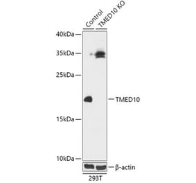 Western Blot - Anti-TMP21 Antibody (A92862) - Antibodies.com