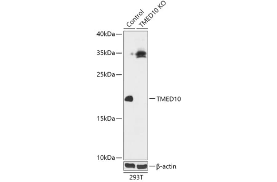Western Blot - Anti-TMP21 Antibody (A92862) - Antibodies.com