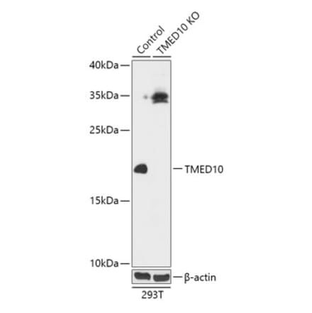 Western Blot - Anti-TMP21 Antibody (A92862) - Antibodies.com