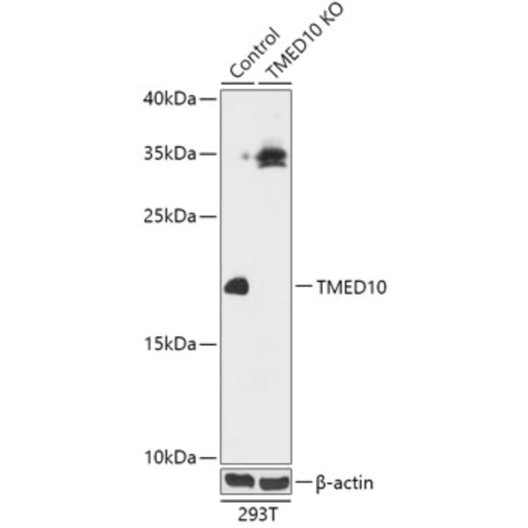 Western Blot - Anti-TMP21 Antibody (A92862) - Antibodies.com