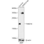Western Blot - Anti-TMP21 Antibody (A92862) - Antibodies.com