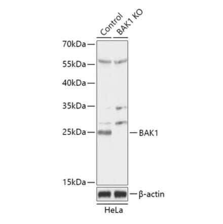 Western Blot - Anti-Bak Antibody (A92863) - Antibodies.com