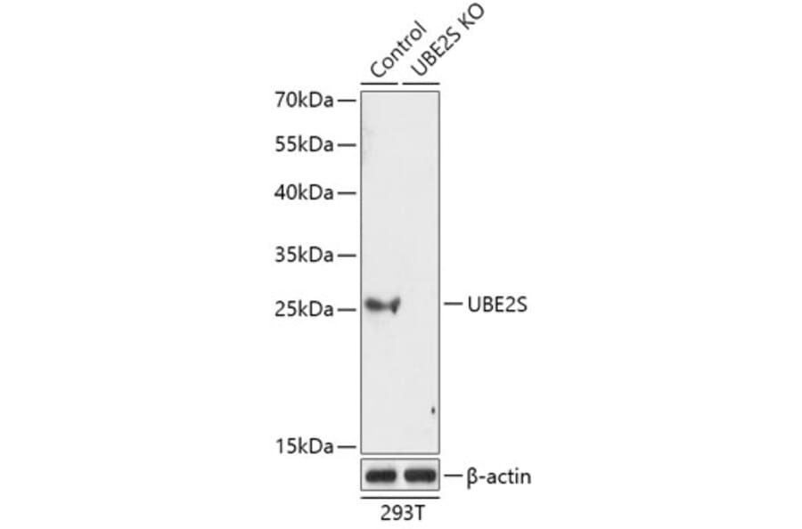 Western Blot - Anti-UBE2S Antibody (A92864) - Antibodies.com