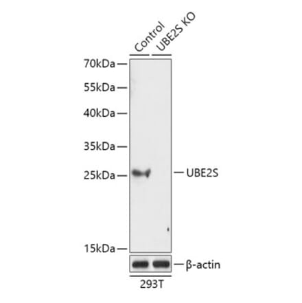 Western Blot - Anti-UBE2S Antibody (A92864) - Antibodies.com