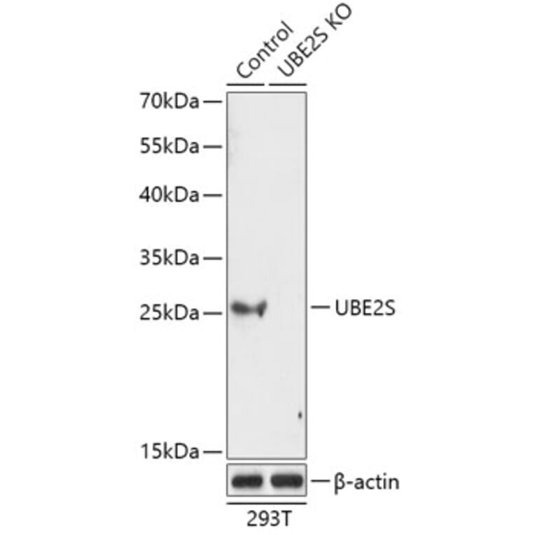 Western Blot - Anti-UBE2S Antibody (A92864) - Antibodies.com