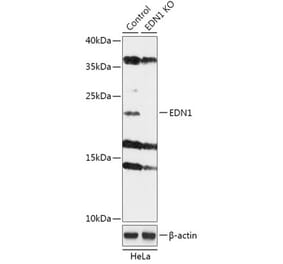 Western Blot - Anti-Endothelin 1 Antibody (A92865) - Antibodies.com