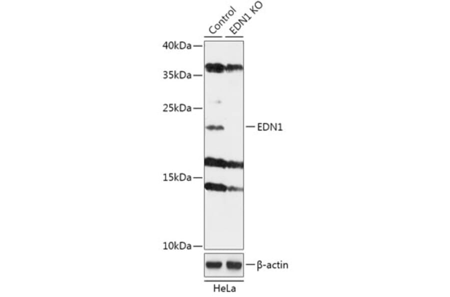 Western Blot - Anti-Endothelin 1 Antibody (A92865) - Antibodies.com
