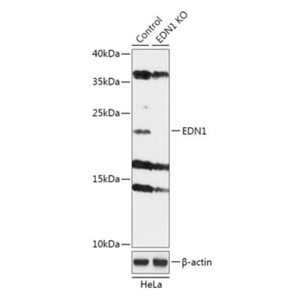 Western Blot - Anti-Endothelin 1 Antibody (A92865) - Antibodies.com