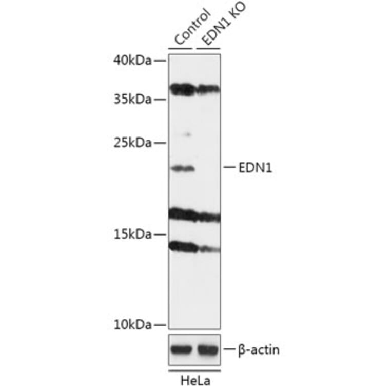 Western Blot - Anti-Endothelin 1 Antibody (A92865) - Antibodies.com