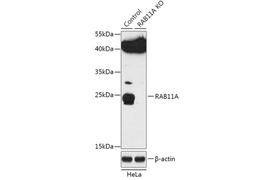 Western Blot - Anti-Rab11A Antibody (A92866) - Antibodies.com