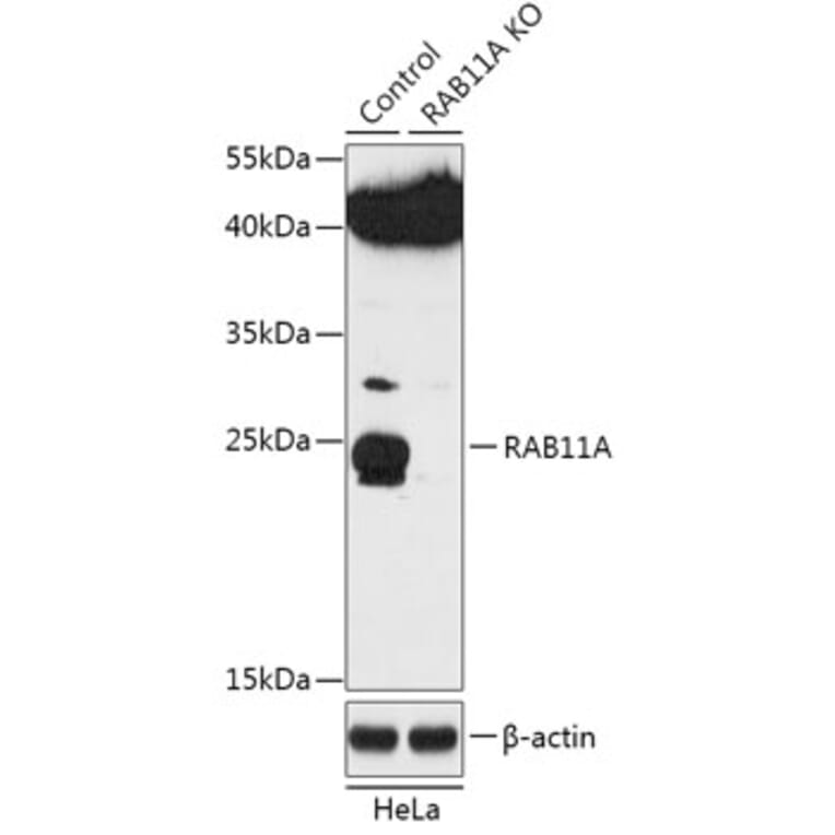 Western Blot - Anti-Rab11A Antibody (A92866) - Antibodies.com