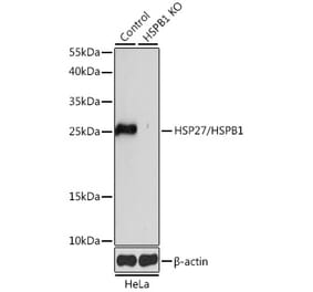 Western Blot - Anti-Hsp27 Antibody (A92868) - Antibodies.com