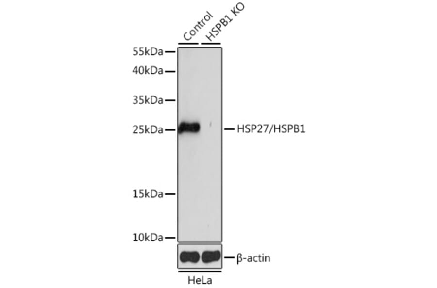 Western Blot - Anti-Hsp27 Antibody (A92868) - Antibodies.com