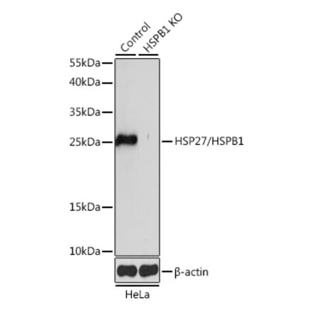 Western Blot - Anti-Hsp27 Antibody (A92868) - Antibodies.com