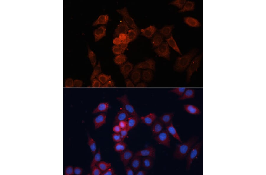 Immunofluorescence - Anti-Hsp27 Antibody (A92868) - Antibodies.com
