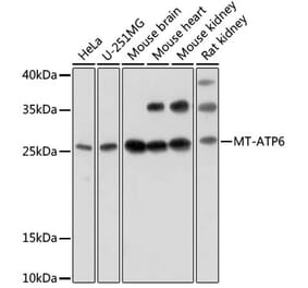 Western Blot - Anti-MT-ATP6 Antibody (A92869) - Antibodies.com