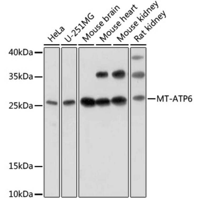 Western Blot - Anti-MT-ATP6 Antibody (A92869) - Antibodies.com