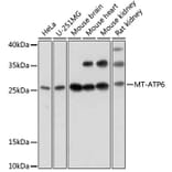 Western Blot - Anti-MT-ATP6 Antibody (A92869) - Antibodies.com