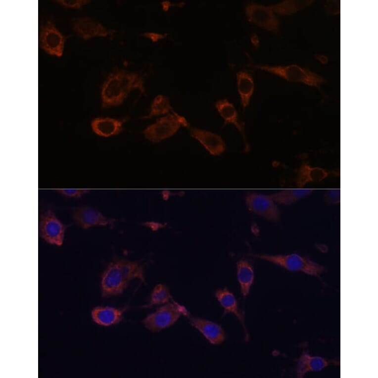 Immunofluorescence - Anti-MT-ATP6 Antibody (A92869) - Antibodies.com