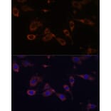 Immunofluorescence - Anti-MT-ATP6 Antibody (A92869) - Antibodies.com