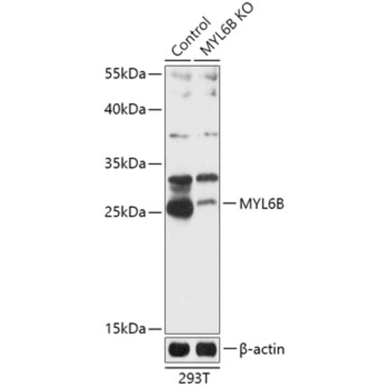 Western Blot - Anti-MLC1SA Antibody (A92872) - Antibodies.com