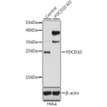 Western Blot - Anti-PDCD10/CCM3 Antibody (A92873) - Antibodies.com