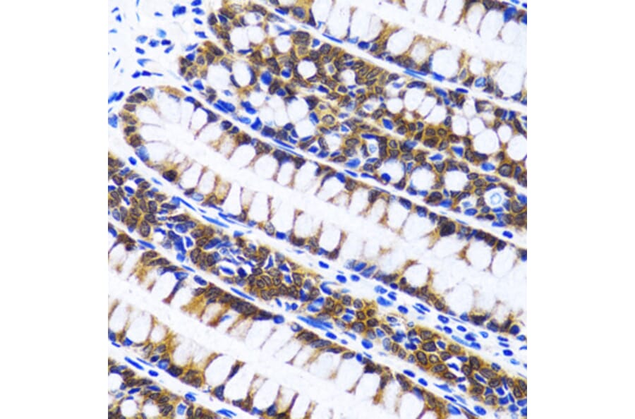 Immunohistochemistry - Anti-FASN Antibody (A0462) - Antibodies.com