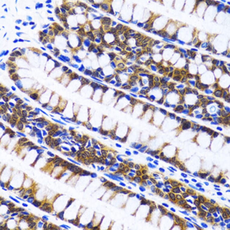 Immunohistochemistry - Anti-FASN Antibody (A0462) - Antibodies.com