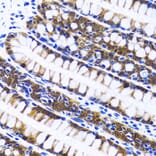 Immunohistochemistry - Anti-FASN Antibody (A0462) - Antibodies.com