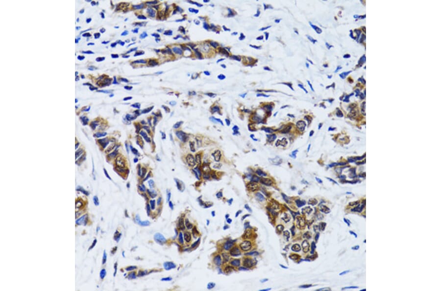 Immunohistochemistry - Anti-FASN Antibody (A0462) - Antibodies.com