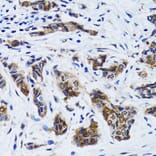 Immunohistochemistry - Anti-FASN Antibody (A0462) - Antibodies.com
