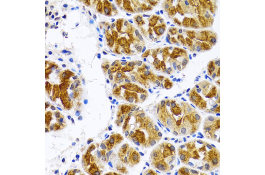 Immunohistochemistry - Anti-FASN Antibody (A0462) - Antibodies.com