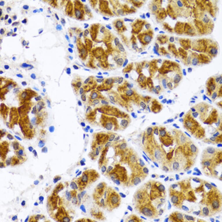 Immunohistochemistry - Anti-FASN Antibody (A0462) - Antibodies.com