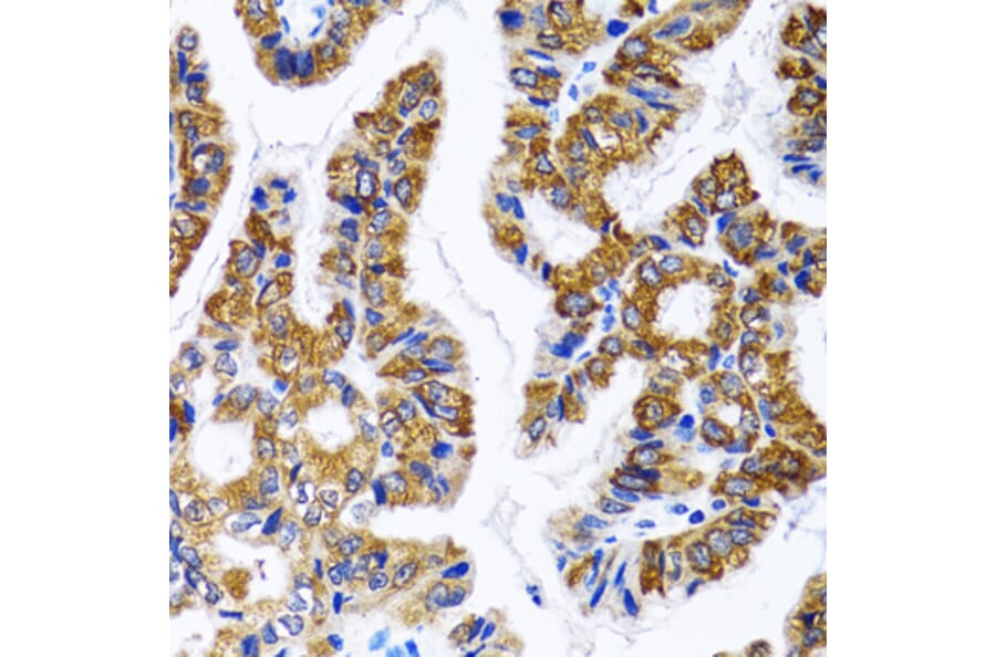 Immunohistochemistry - Anti-FASN Antibody (A0462) - Antibodies.com