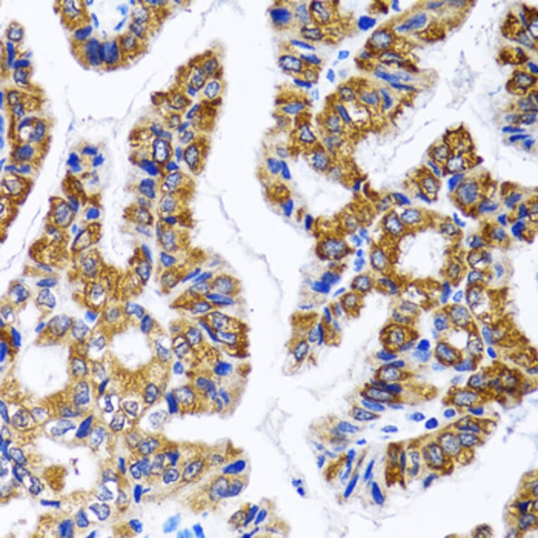 Immunohistochemistry - Anti-FASN Antibody (A0462) - Antibodies.com