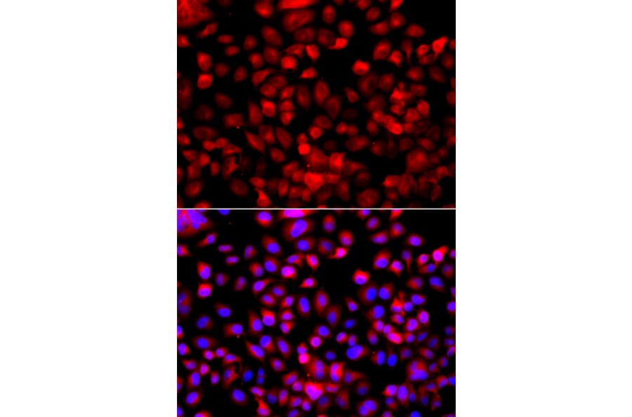 Immunofluorescence - Anti-FASN Antibody (A0462) - Antibodies.com