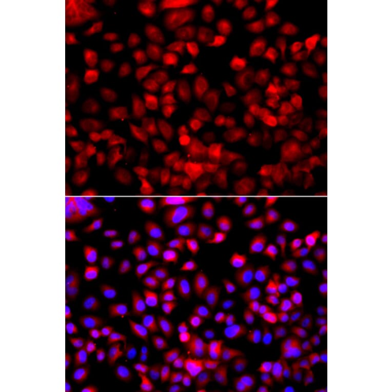 Immunofluorescence - Anti-FASN Antibody (A0462) - Antibodies.com