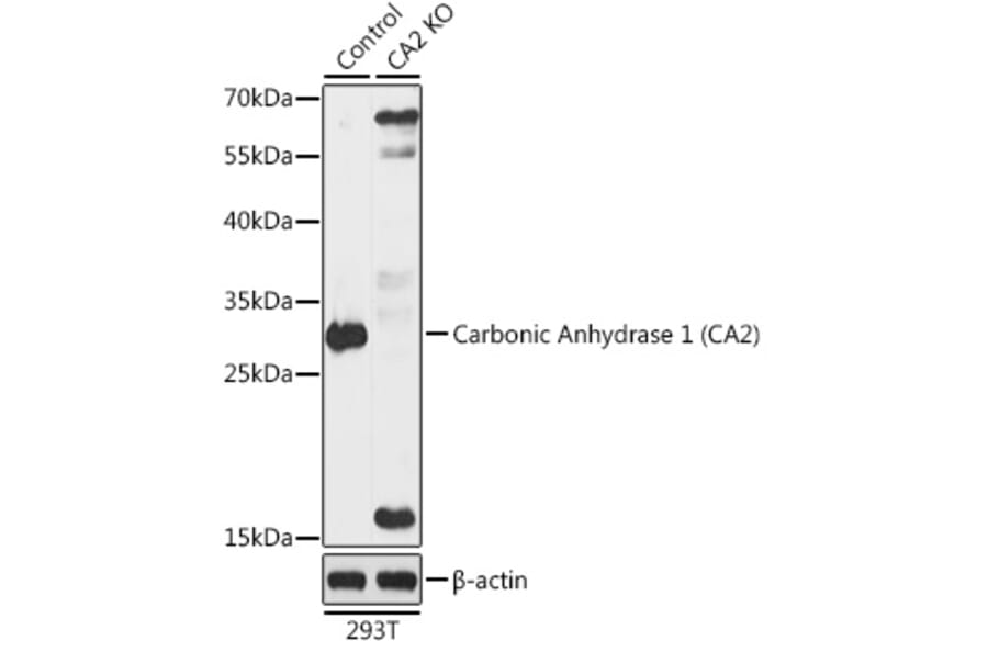 Western Blot - Anti-Carbonic anhydrase 2/CA2 Antibody (A92875) - Antibodies.com