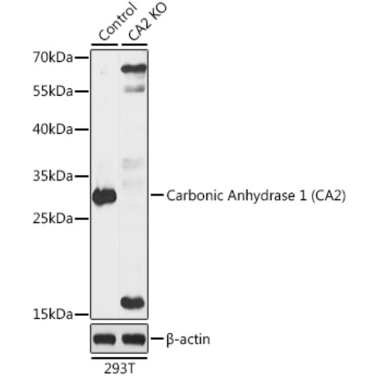 Western Blot - Anti-Carbonic anhydrase 2/CA2 Antibody (A92875) - Antibodies.com