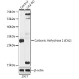 Western Blot - Anti-Carbonic anhydrase 2/CA2 Antibody (A92875) - Antibodies.com
