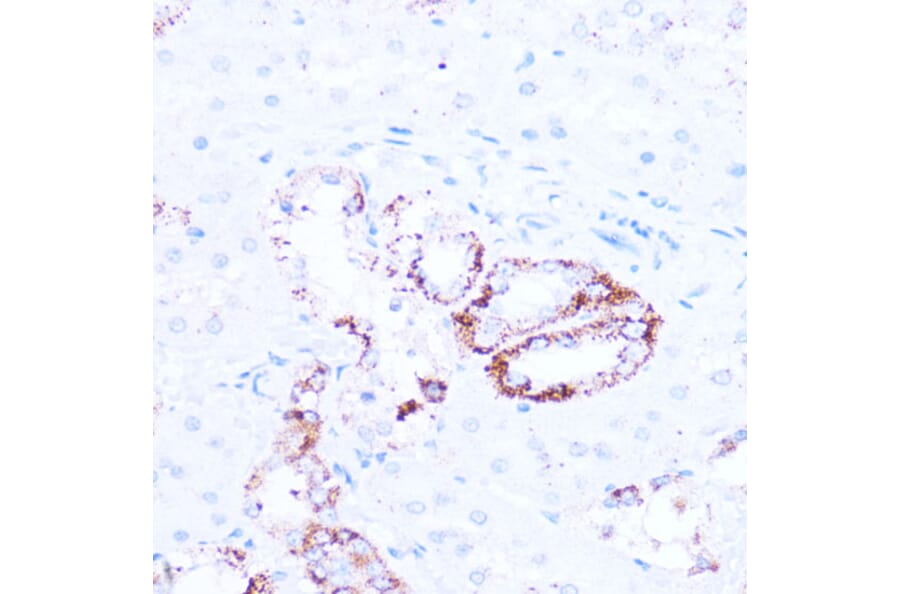 Immunohistochemistry - Anti-SIRT3 Antibody (A92878) - Antibodies.com