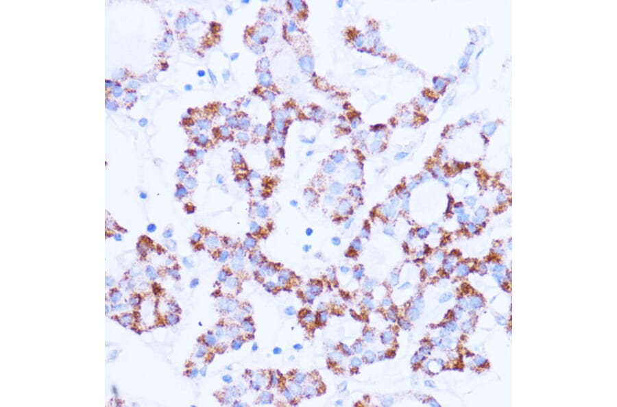 Immunohistochemistry - Anti-SIRT3 Antibody (A92878) - Antibodies.com