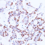Immunohistochemistry - Anti-SIRT3 Antibody (A92878) - Antibodies.com